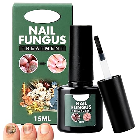 Toenail Treatment Extra Strength, Nail Care Serum for Restorative Broken Discolored Damaged Thick Nails Improves Appearance, Softening Nail Treatment Oil with Herbal Extract for Daily Care, 0.5 Fl Oz